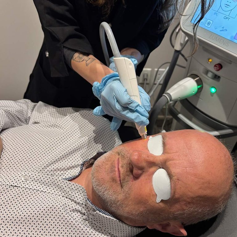 Dry-Eye-Treatment-768x768
